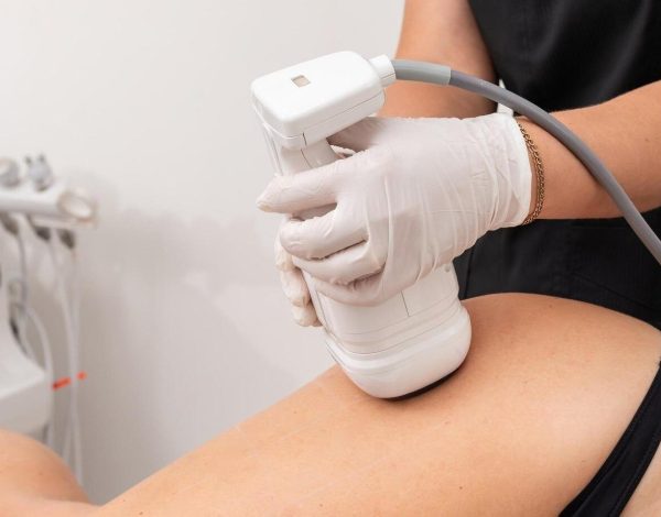 liposonix-es-dispositivo-moldear-transformed